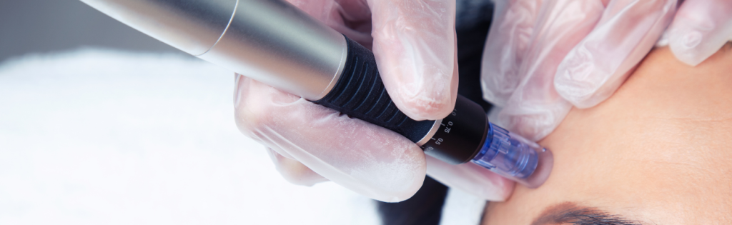 An image of a Dermapen, a handheld device used for microneedling treatments. The Dermapen features fine needles and is designed to improve skin texture and appearance through controlled micro-injuries.