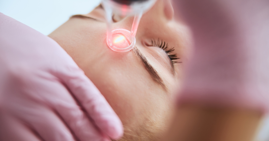 Close-up of a skincare specialist applying a laser device to a client’s face during a professional facial treatment in a clinic.