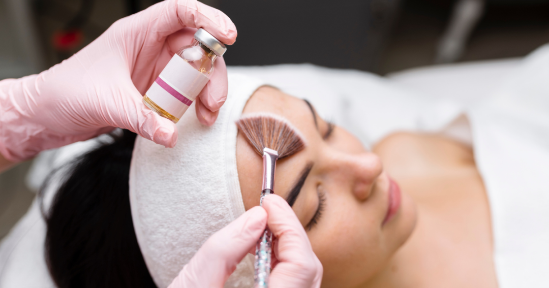 How Often Should You Get a Chemical Peel? 1 Close-up of an aesthetician applying a chemical peel solution to a woman’s face during treatment.