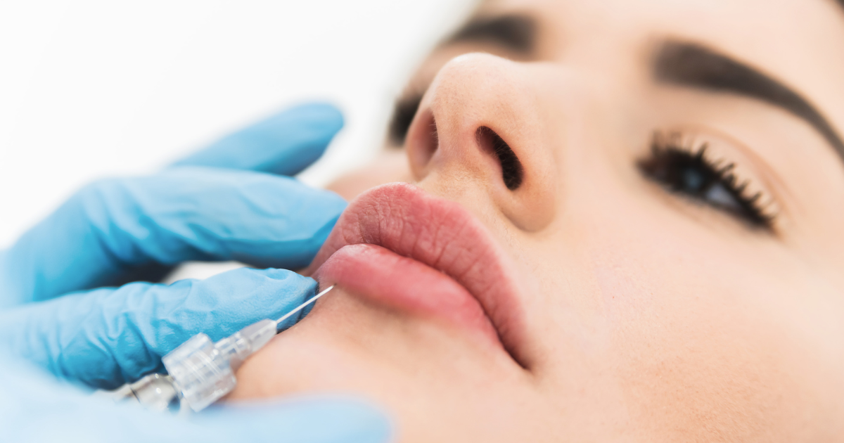Allergic Reactions and Dermal Fillers: What Every Patient Should Know 1 Close-up of a cosmetic practitioner in gloves injecting dermal filler into a client’s face to enhance facial volume.