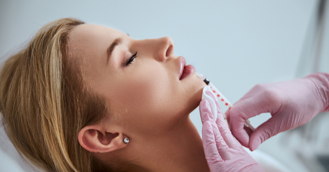 Close-up of a patient receiving cosmetic lip filler injections to improve lip fullness and contour.