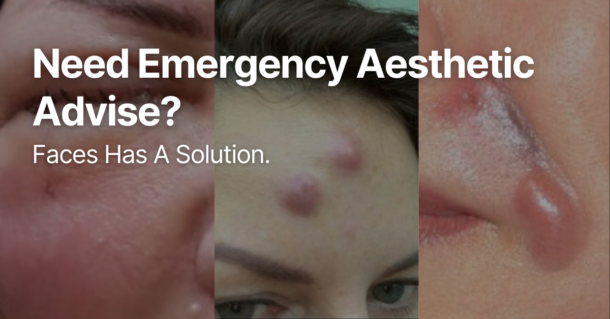 Need Emergency Aesthetic Advise? Faces Has A Solution
