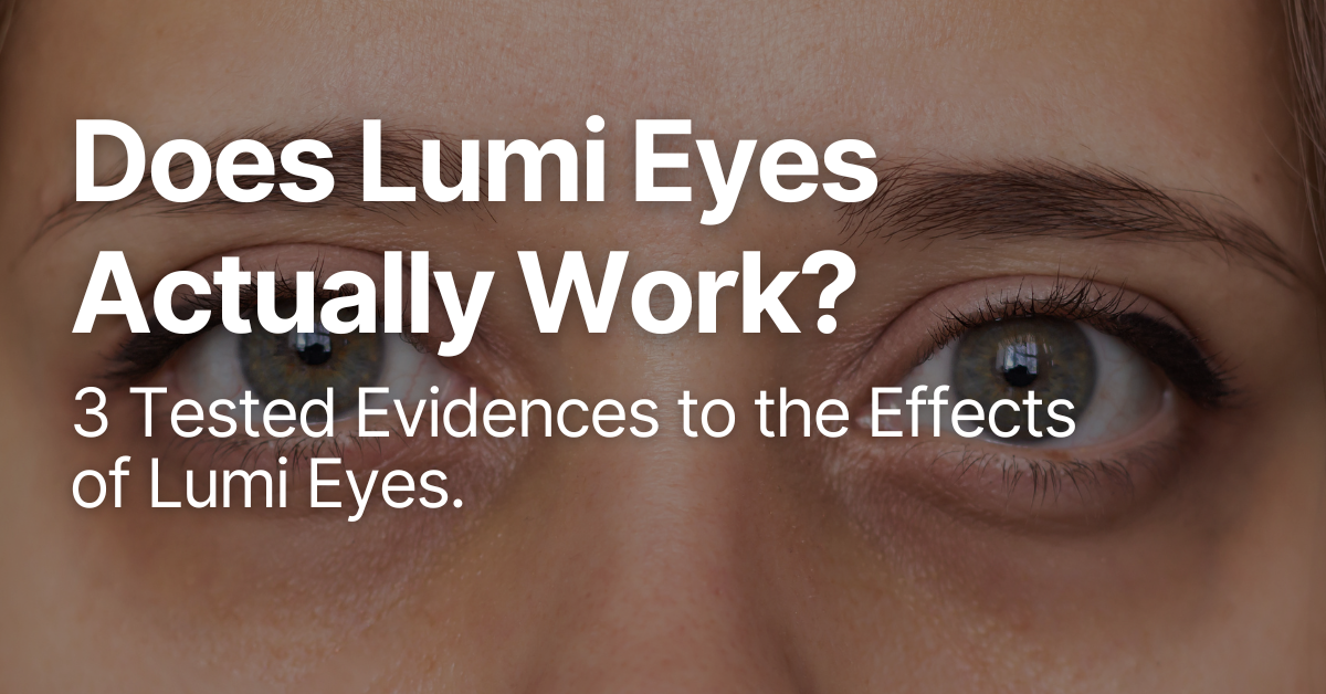 Does Lumi Eyes Work? Here’s 3 Reasons Why It Works!