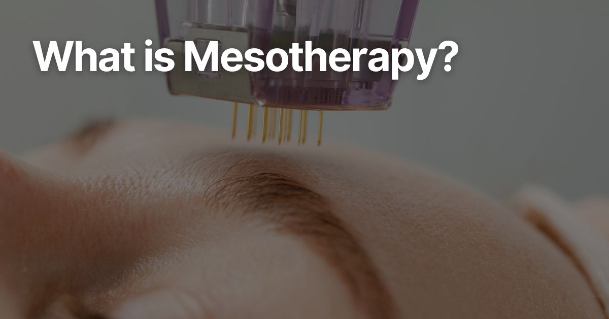 Close-up of a client receiving mesotherapy injection in the skin from a practitioner.