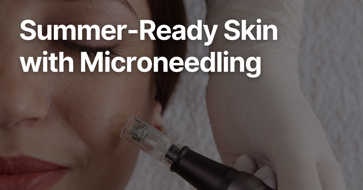 Blog Posts Featured Image 2026 03 10T141519.537