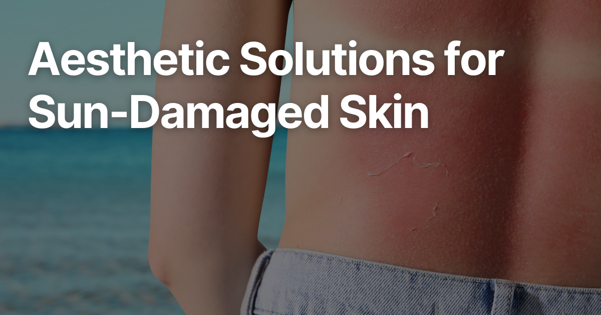 Blog Posts Featured Image 2026 03 10T143412.600