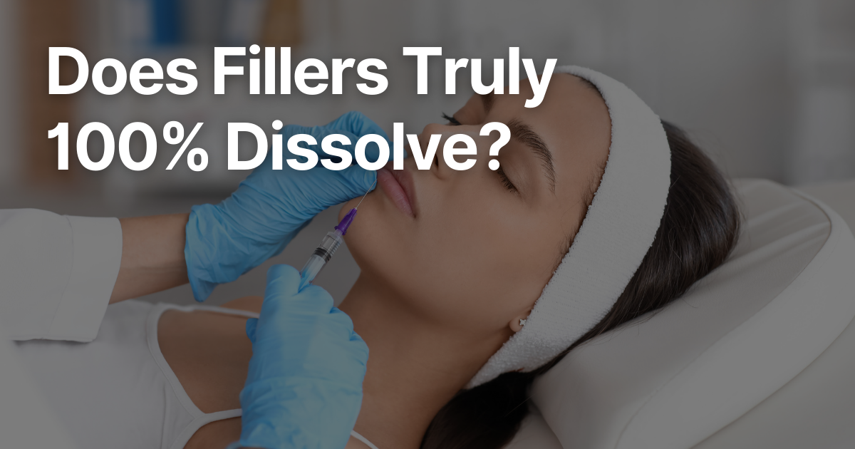 Blog Posts Featured Image 2026 03 10T144901.627