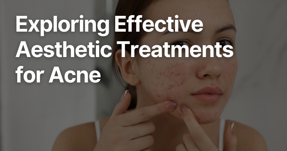 Blog Posts Featured Image 2026 03 10T145127.526