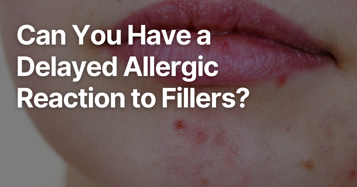 Blog Posts Featured Image 2026 03 10T150441.699