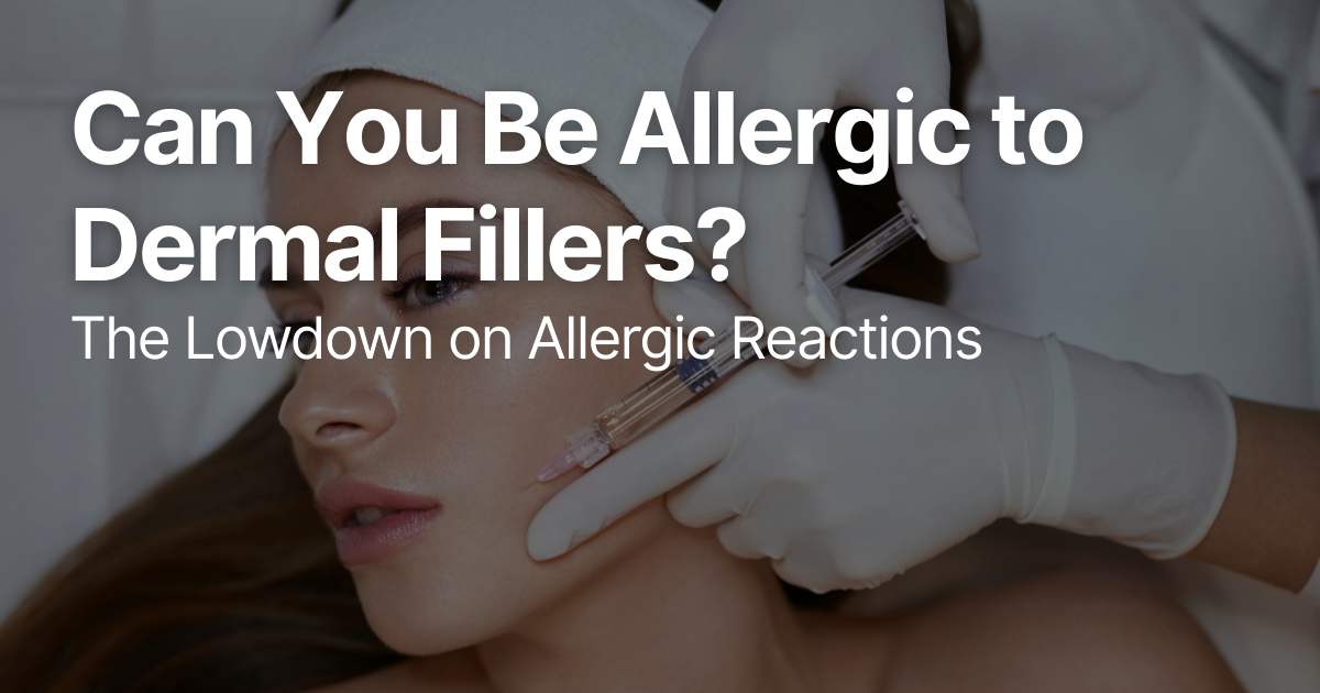 Blog Posts Featured Image 2026 03 12T121740.924