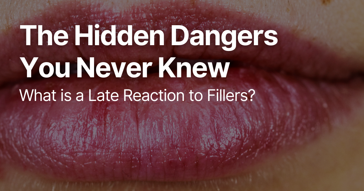 Blog Posts Featured Image 2026 03 12T123508.958