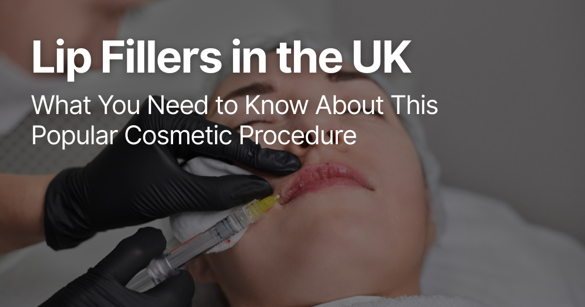 Blog Posts Featured Image 2026 03 12T123900.924