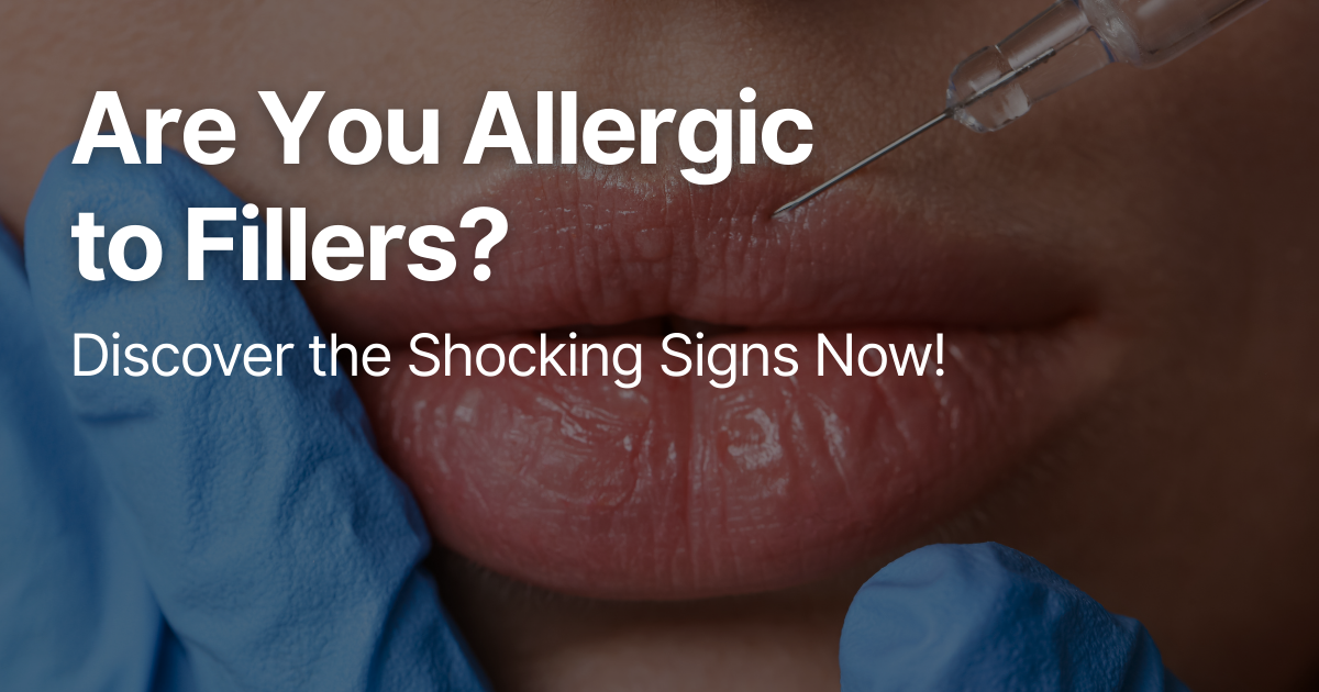 Blog Posts Featured Image 2026 03 12T124205.998