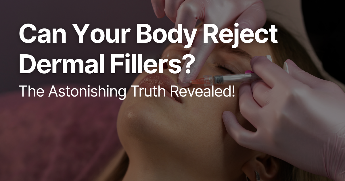 Blog Posts Featured Image 2026 03 12T124237.320