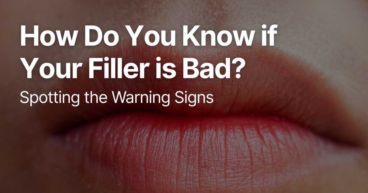 Blog Posts Featured Image 2026 03 12T125000.681