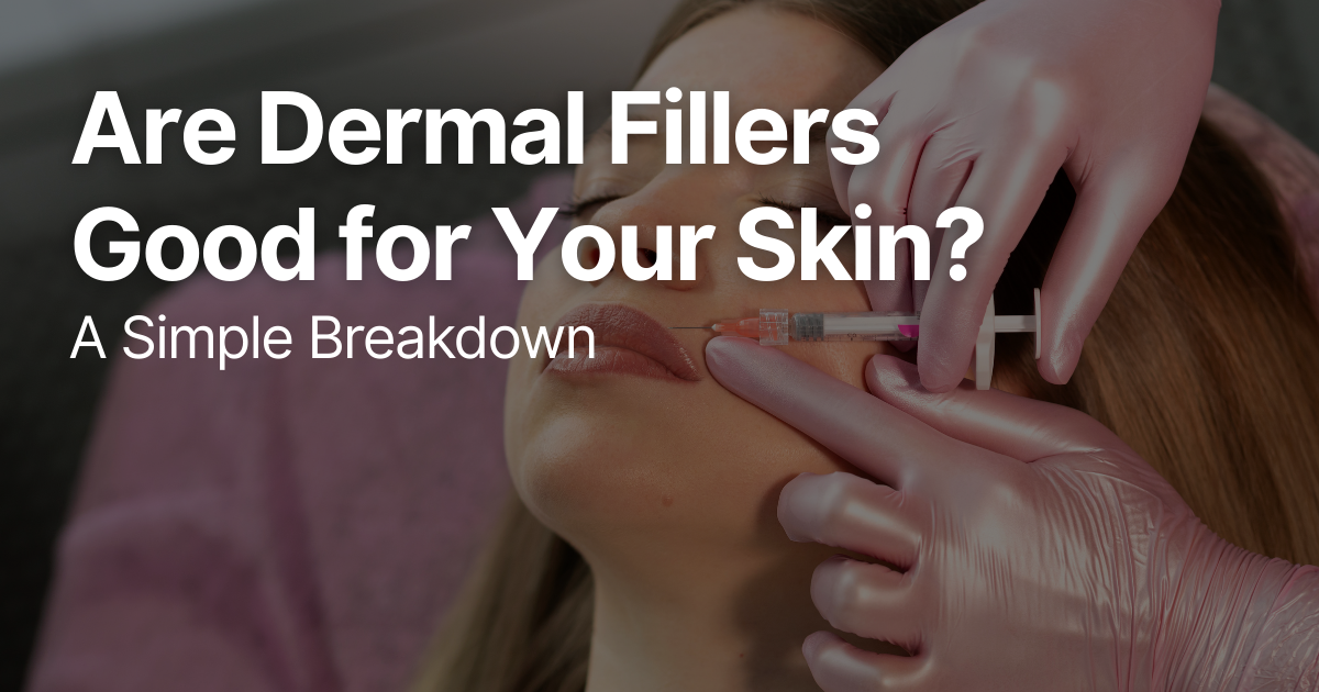 Blog Posts Featured Image 2026 03 12T131610.752