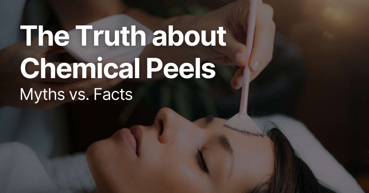 Blog Posts Featured Image 30 2