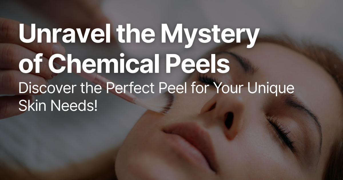 Blog Posts Featured Image 36 2