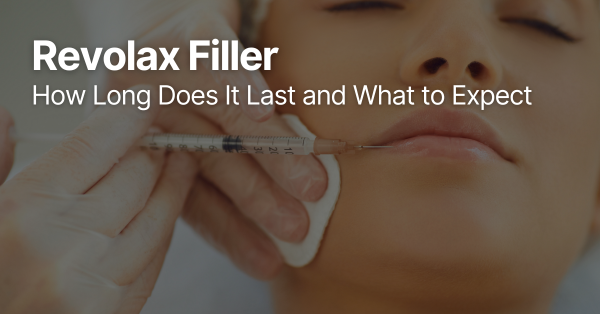 Close-up of a patient receiving Revolax dermal filler injection in the cheek area by a trained practitioner wearing medical gloves.