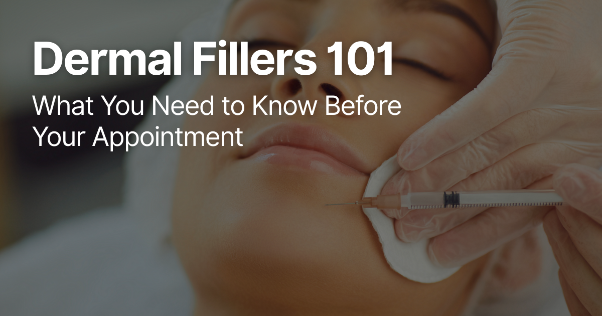 Blog Posts Featured Image 47 2