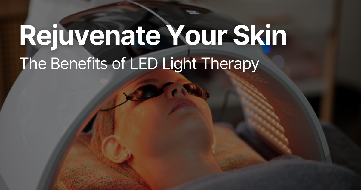 Blog Posts Featured Image 49 2