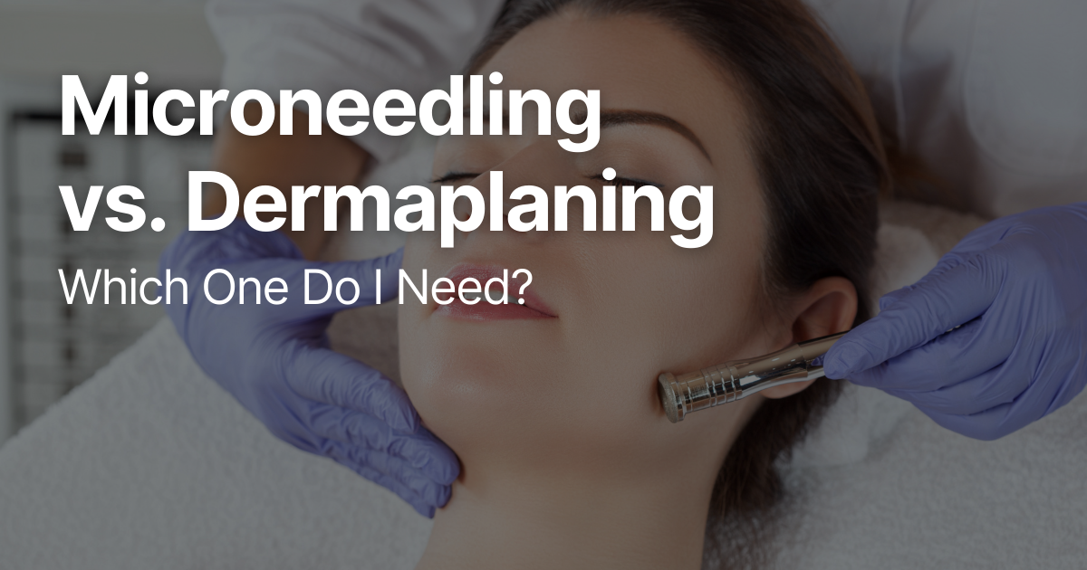 Blog Posts Featured Image 56 2