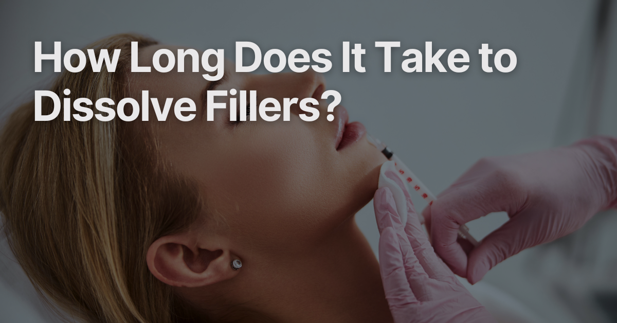 Blog Posts Featured Image 62