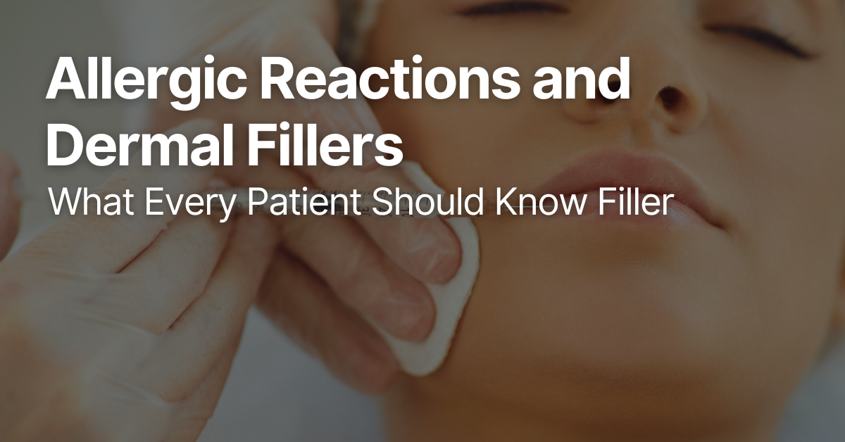 Blog Posts Featured Image 64 1