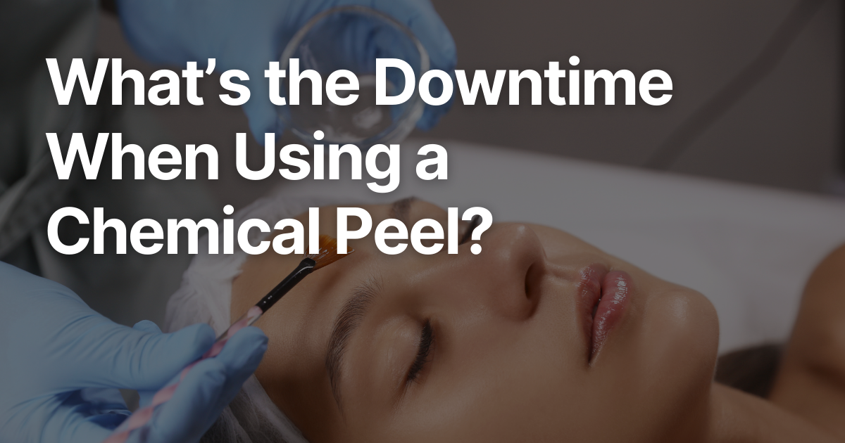 Blog Posts Featured Image 75 2