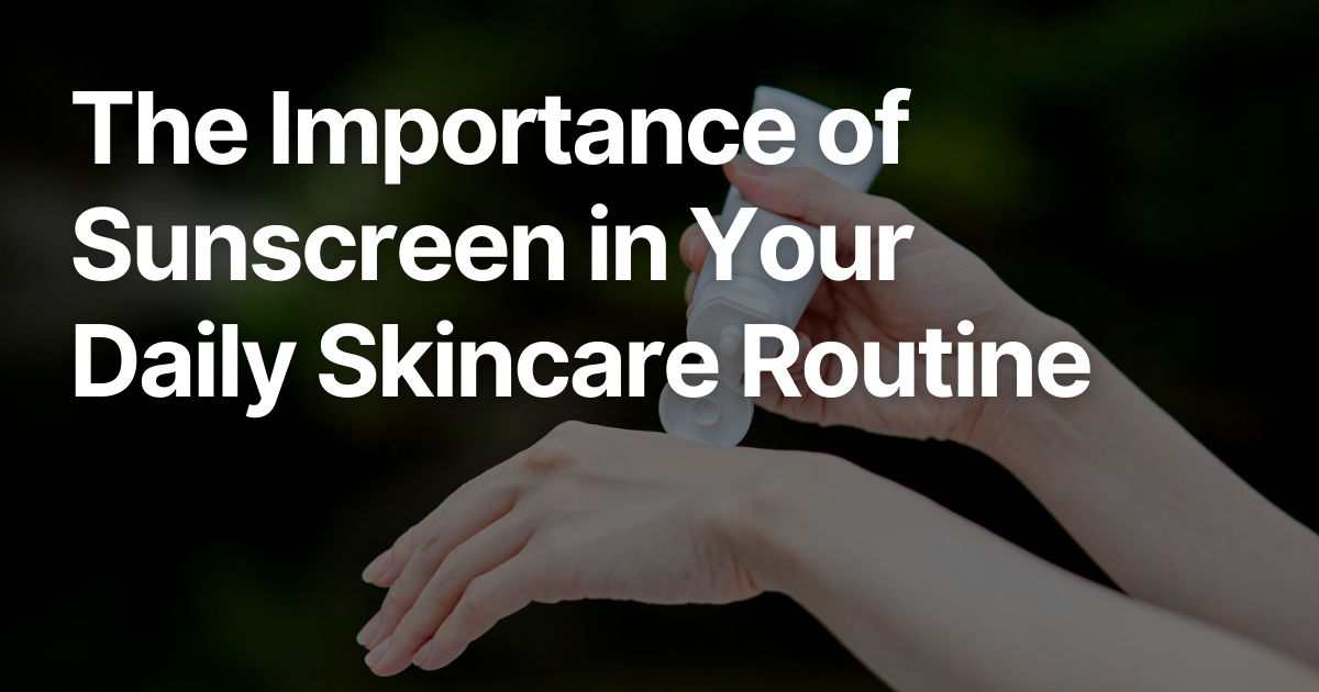 Blog Posts Featured Image 77 2