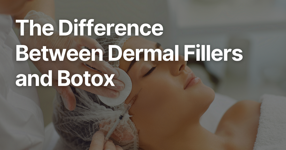 Blog Posts Featured Image 78 2