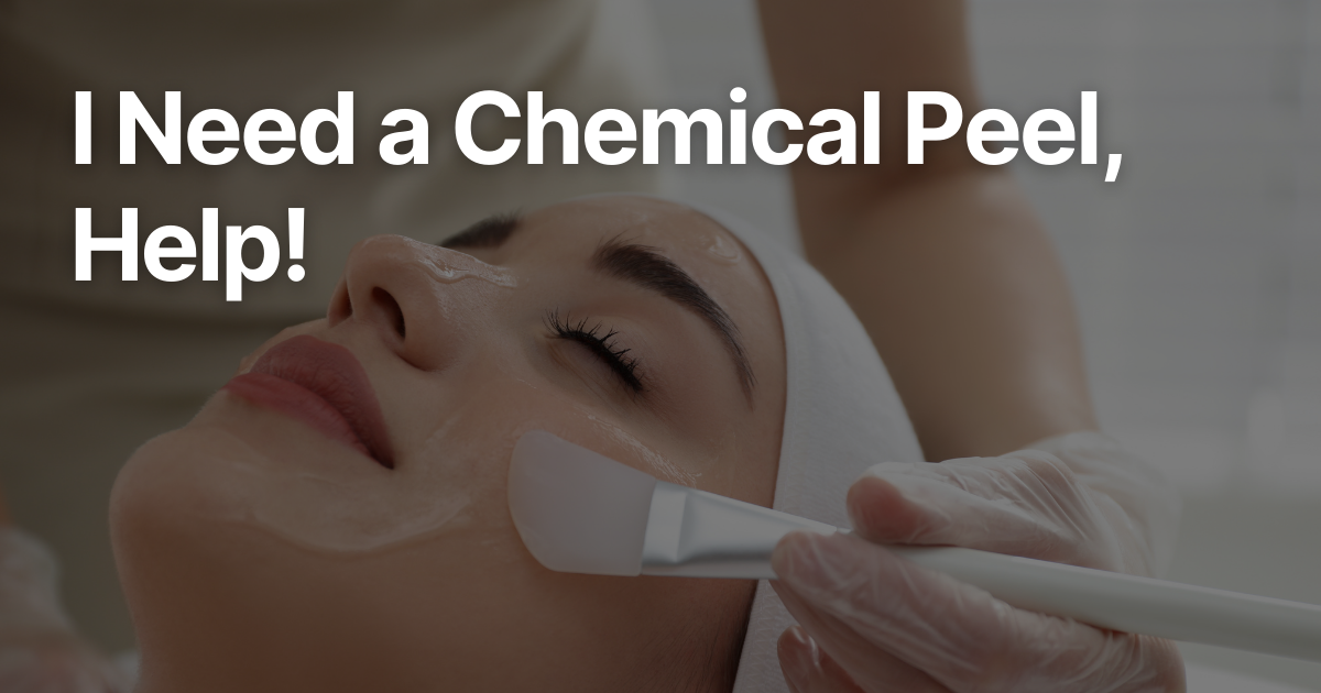 Blog Posts Featured Image 82 4