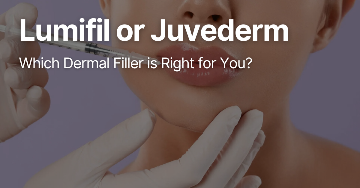 Blog Posts Featured Image 83