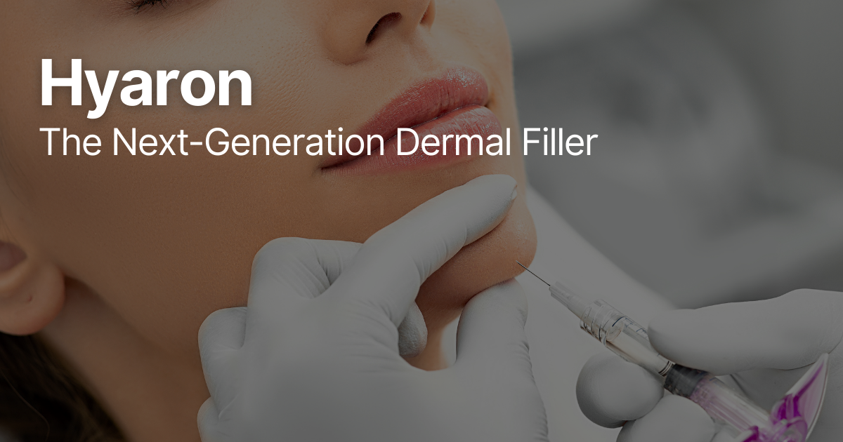 Blog Posts Featured Image 96