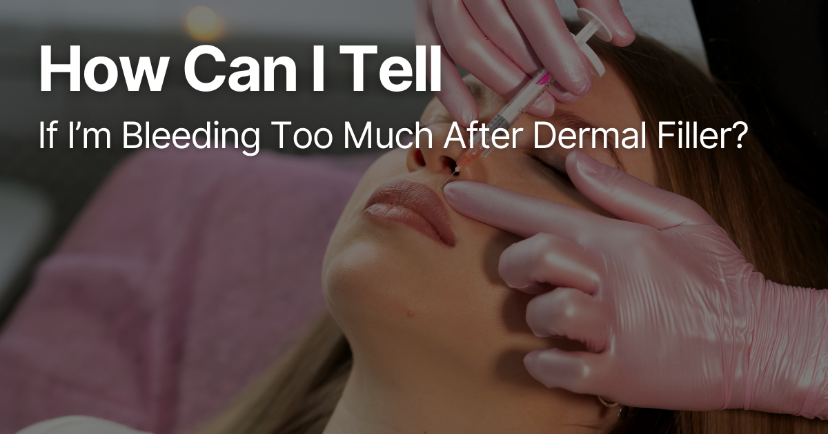 Blog Posts Featured Image 98