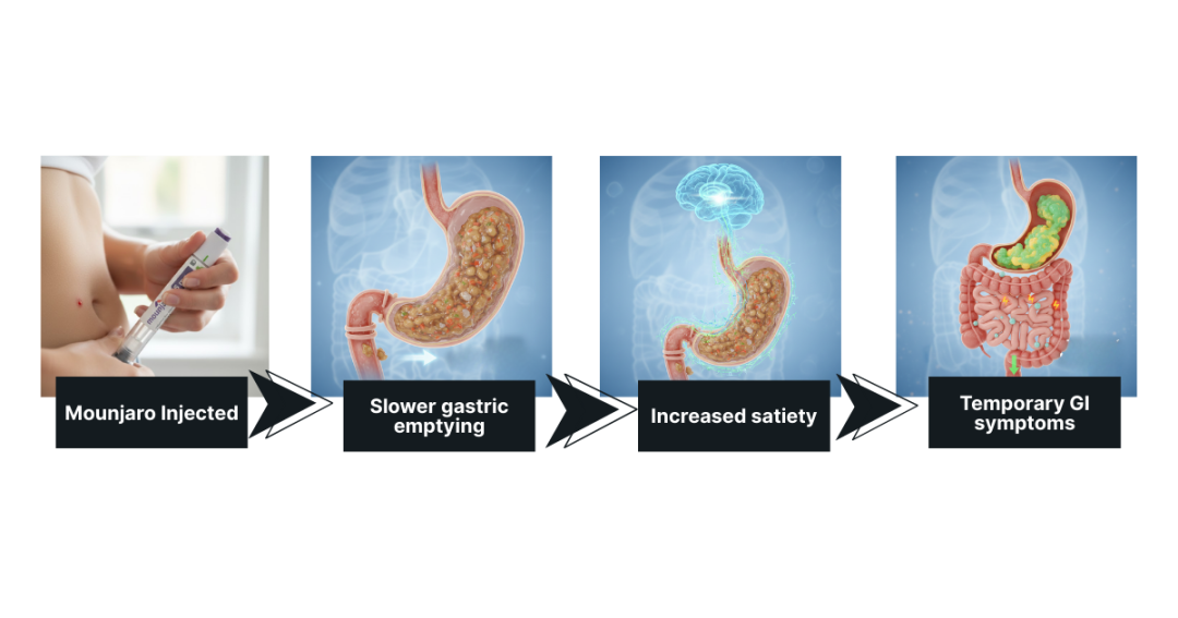 Understanding Mounjaro Side Effects: A Practical Guide for UK Aesthetic Practitioners 1 cause and effect flow of mounjaro to our digestive system