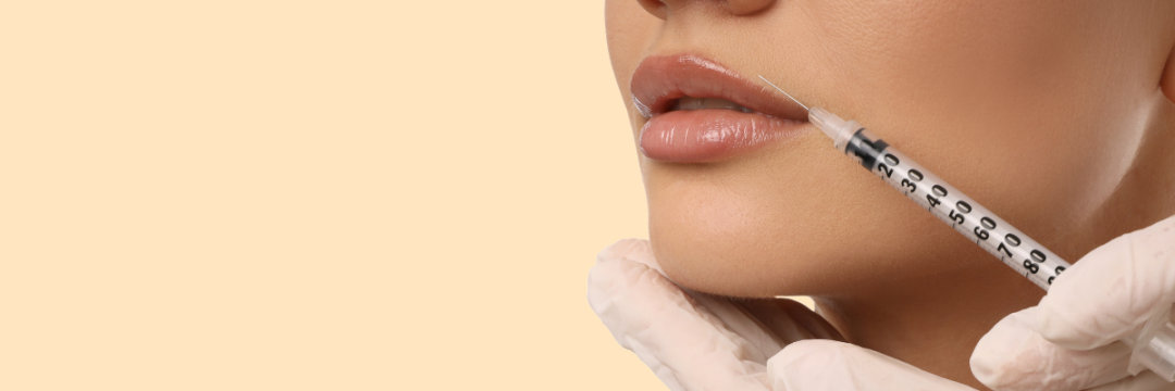Patient getting lip filler.