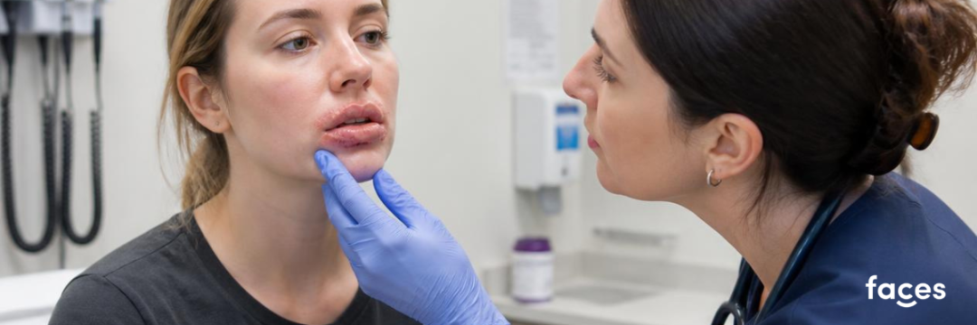 Cold Sore Before Lip Filler and When to Defer 2 A patient with inflammed lips being checked by a practitioner.