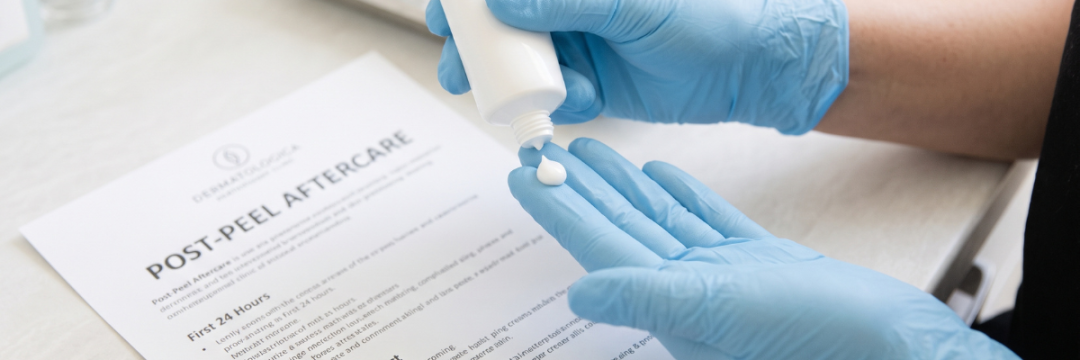 applying a thin layer of barrier cream after a chemical peel as part of written aftercare instructions