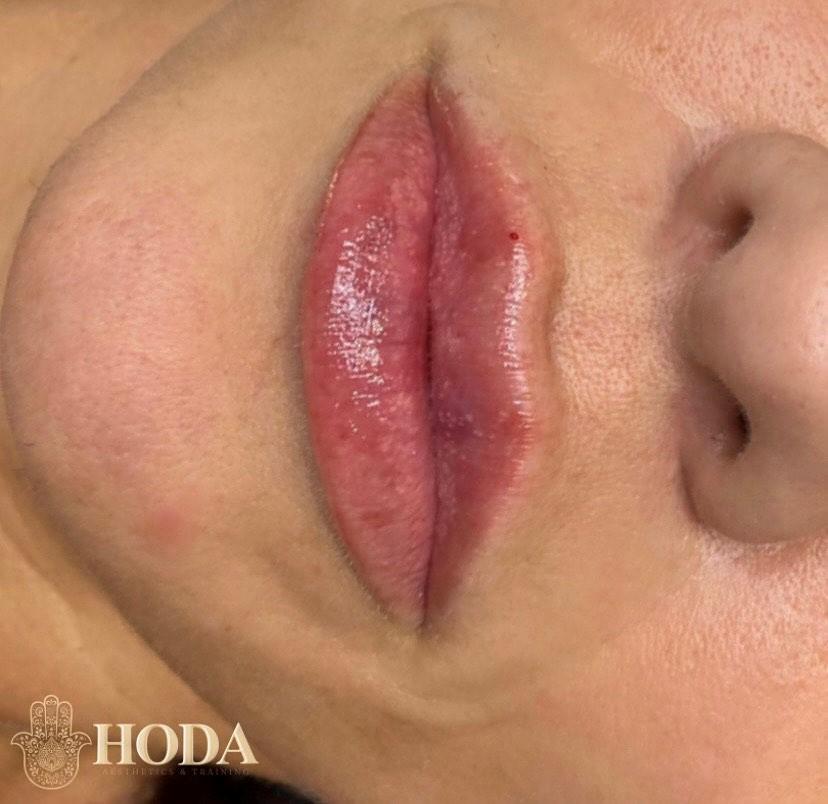 Aesthetic and Training By Hoda image 2