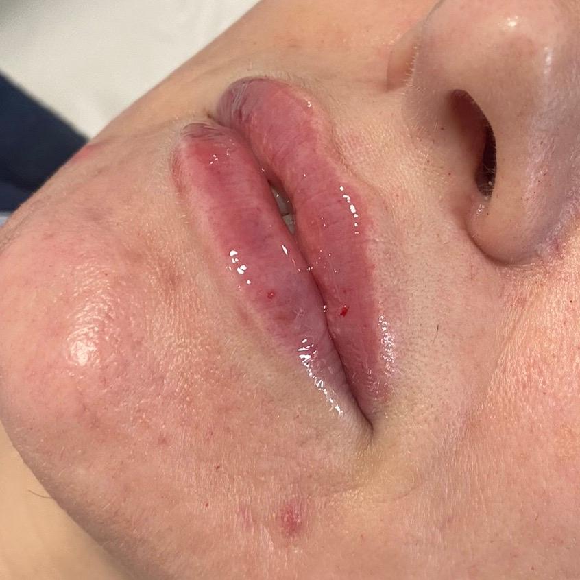 Blush aesthetics clinic image 3