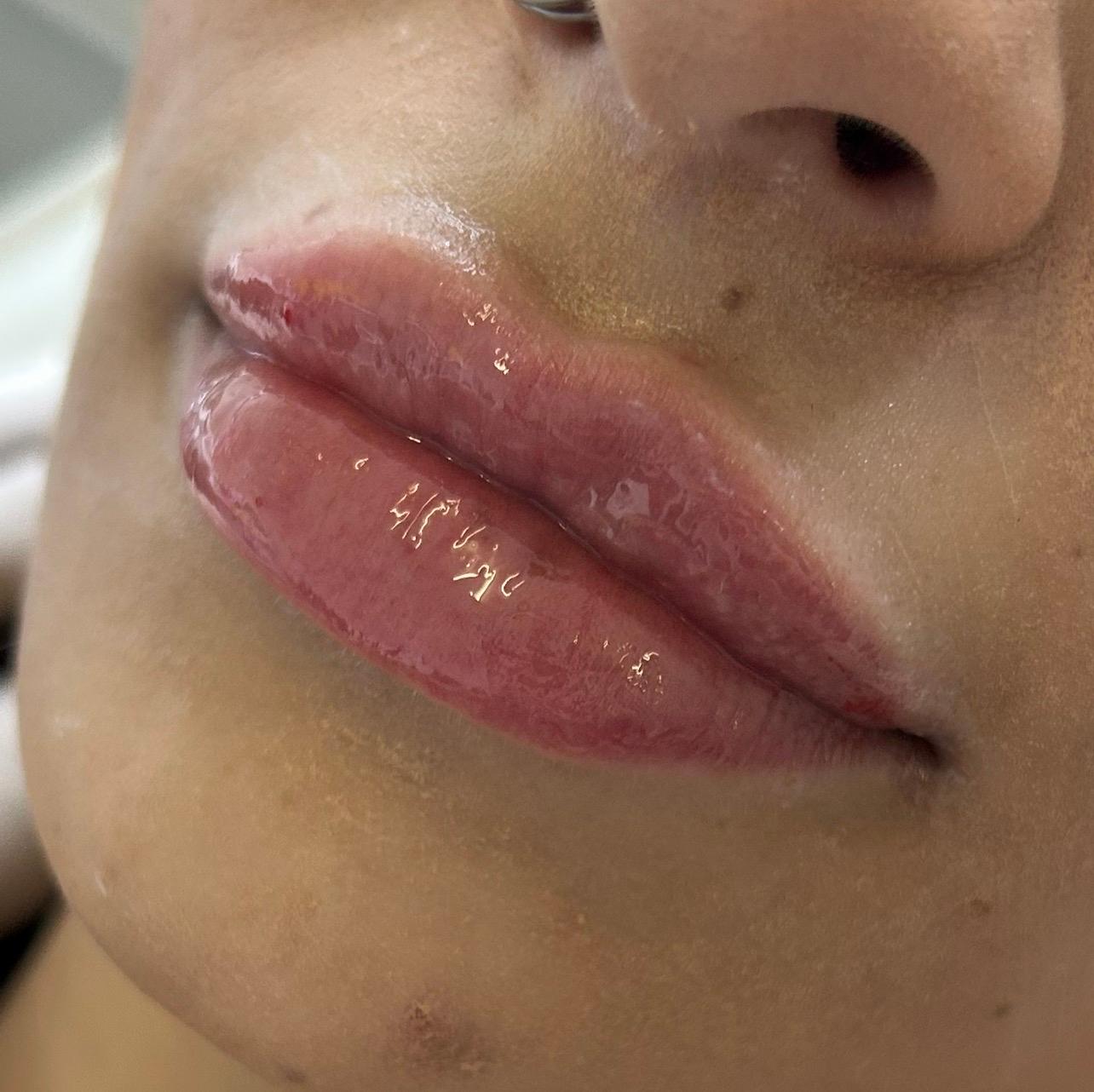 Blush aesthetics clinic image 2