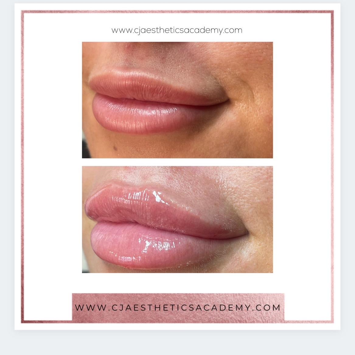 Cj Aesthetics Training Academy image 2