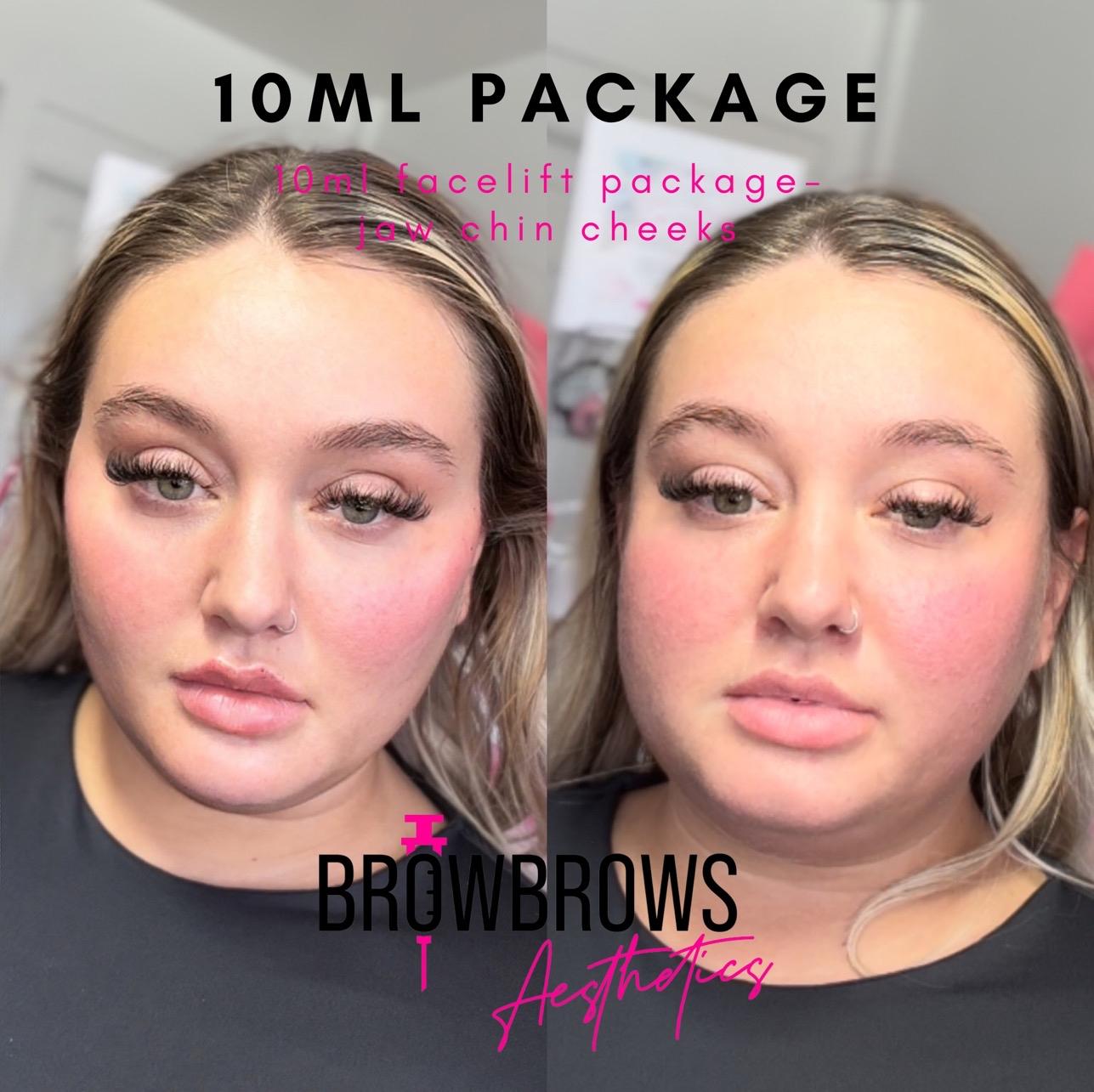Browbrows ltd goldthorpe image 2