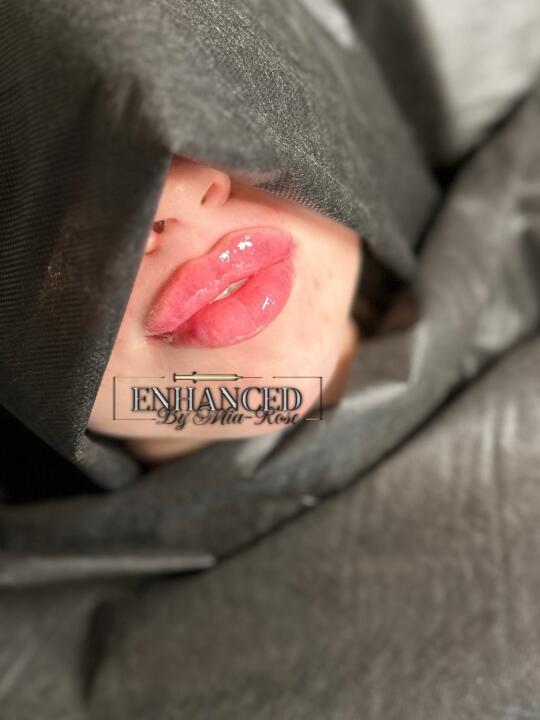 Enhanced by Mia-Rose