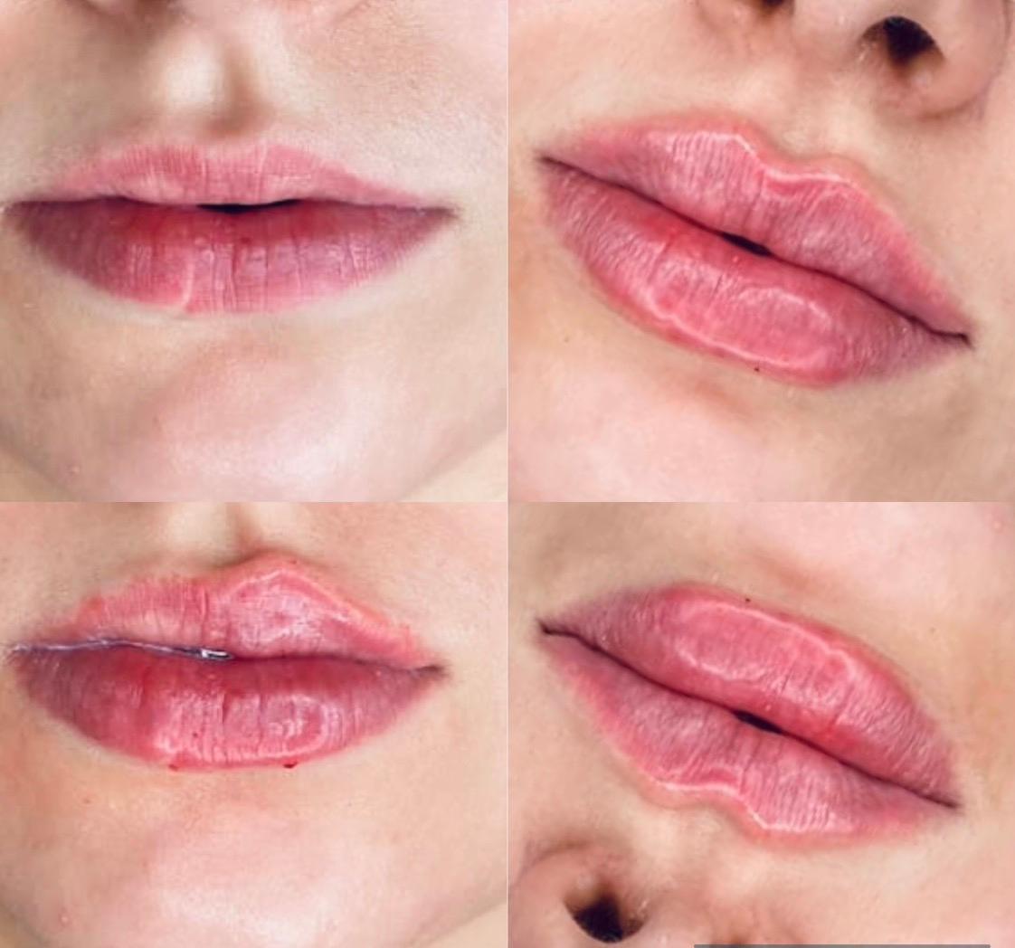 OnPoint Aesthetics image 2
