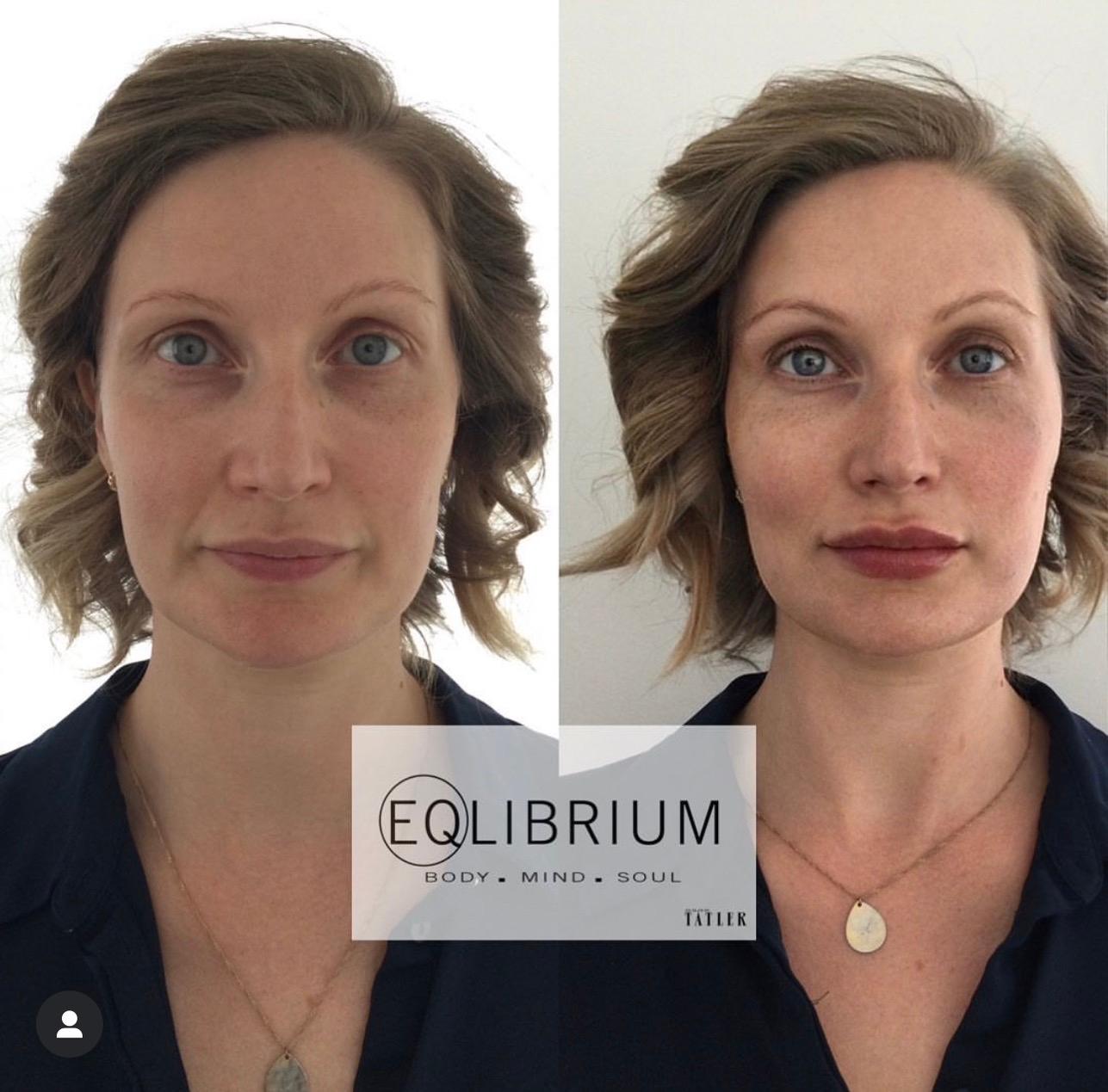 EQlibrium Clinic image 2