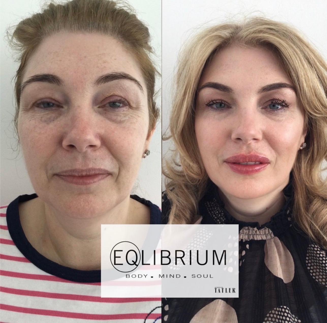 EQlibrium Clinic image 3