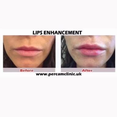 Percam clinic image 2