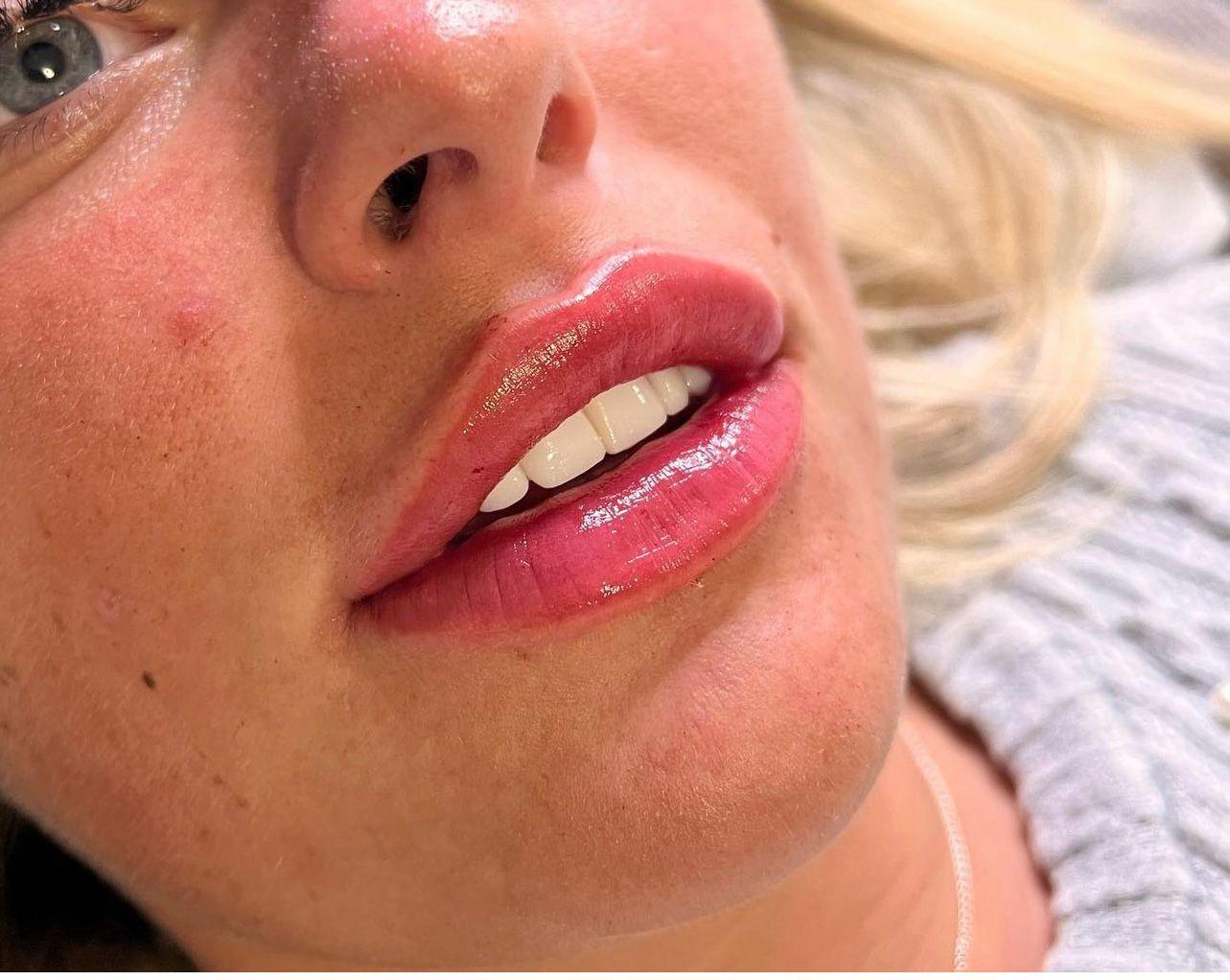 The Beauty spot image 1